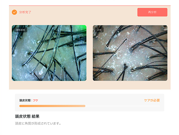 各項目結果の画像